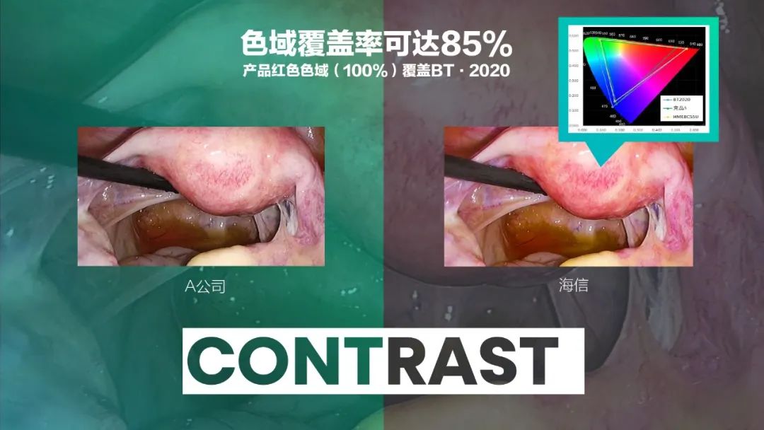 重磅!海信发布全球首台55吋Mini-LED医用内窥显示器! 重磅!海信发布全球首台55吋Mini-LED医用内窥显示器!