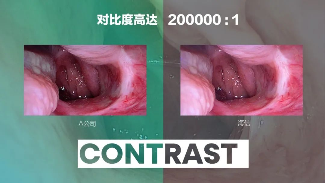 重磅!海信发布全球首台55吋Mini-LED医用内窥显示器! 重磅!海信发布全球首台55吋Mini-LED医用内窥显示器!